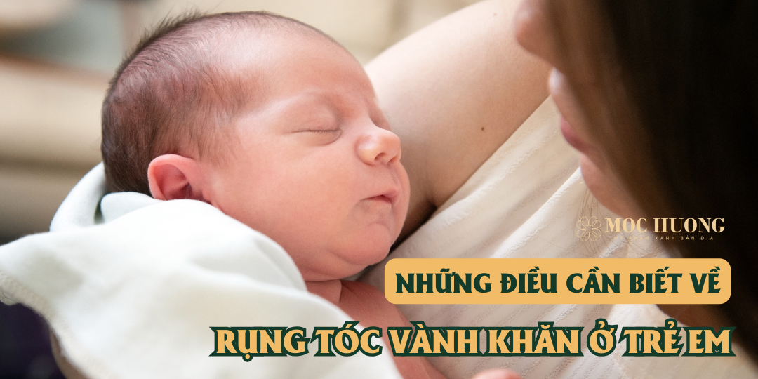 Những điều cần biết về rụng tóc vành khăn ở trẻ em