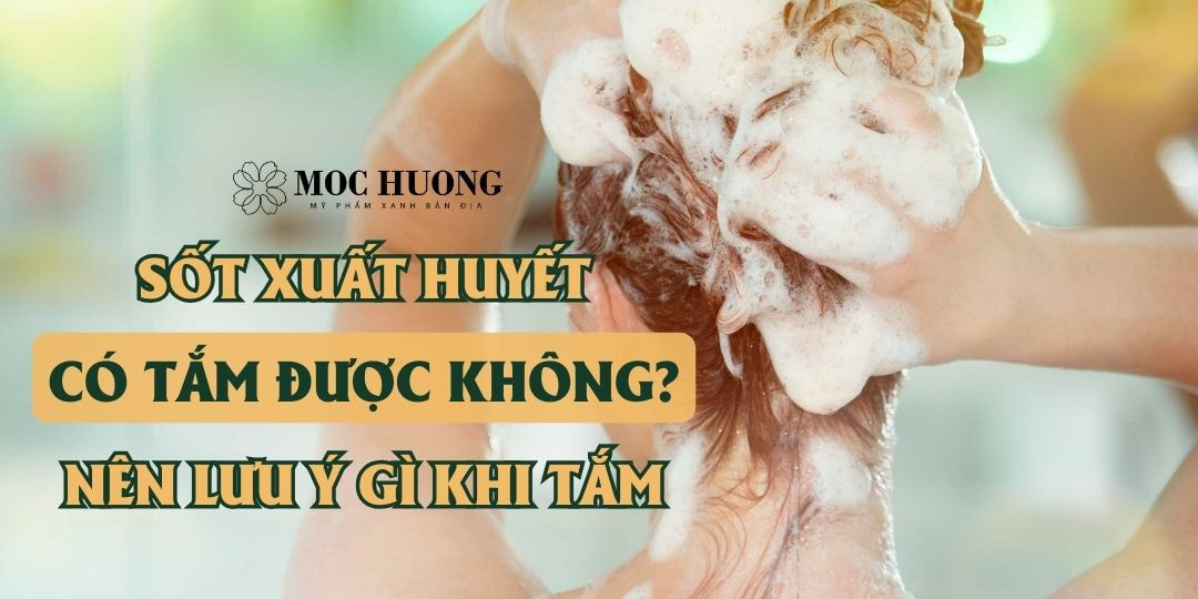 Sốt xuất huyết có tắm được không? Nên lưu ý gì khi tắm