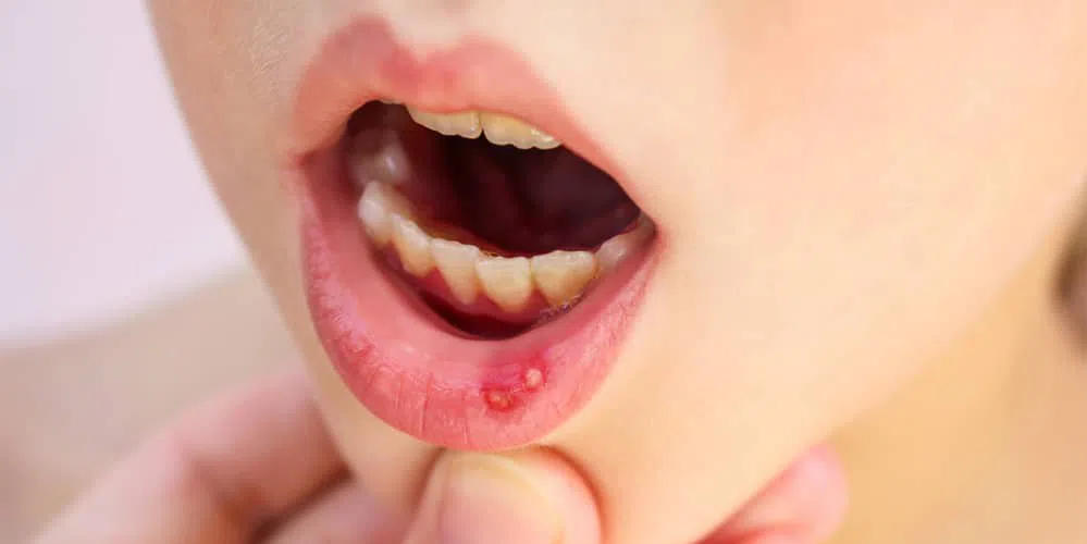 5 triệu chứng cảnh báo cơ thể đang thiếu hụt vitamin và khoáng chất, cần bổ sung ngay