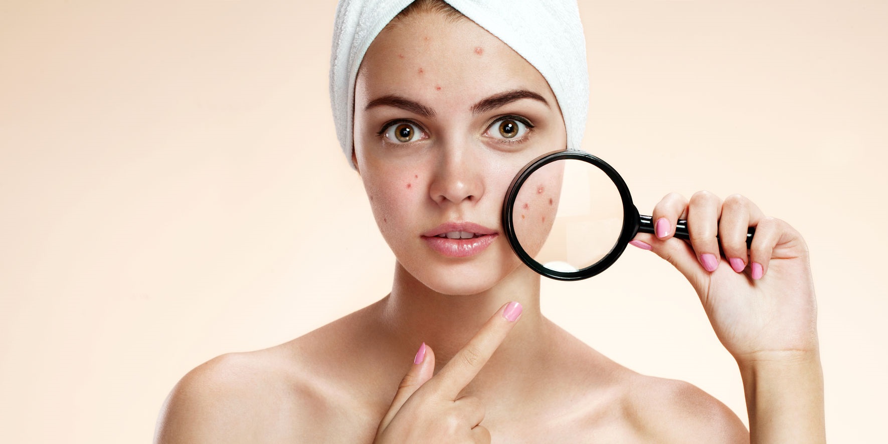 Chăm sóc da hàng ngày như thế nào để tránh lên mụn?