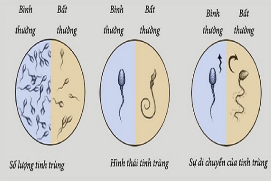 CHẤT LƯỢNG TINH TRÙNG ẢNH HƯỞNG NHƯ THẾ NÀO ĐỐI VỚI QUÁ TRÌNH THỤ THAI