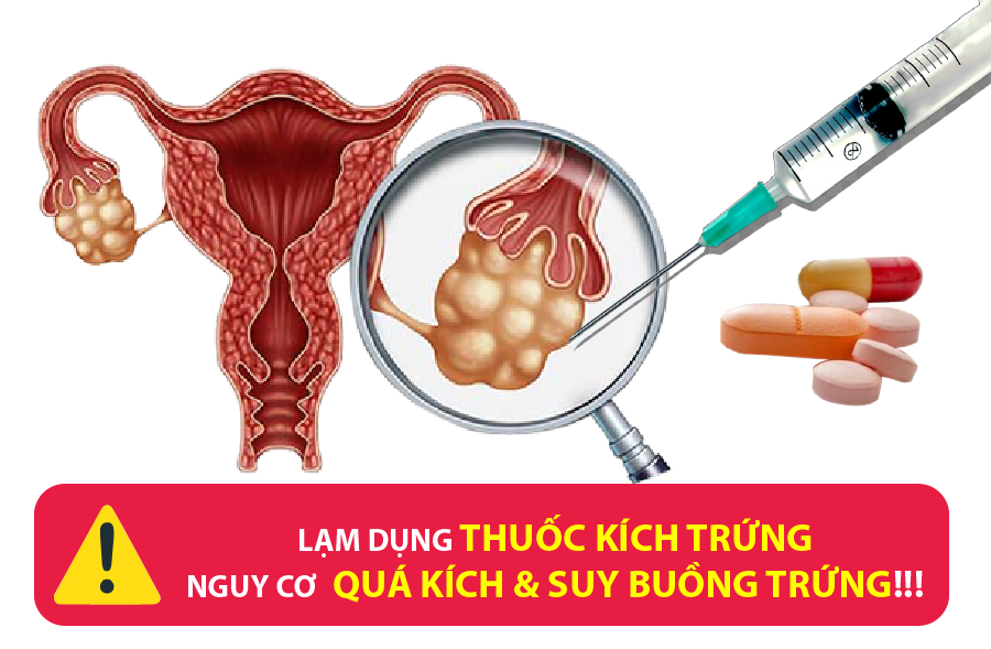 THUỐC KÍCH TRỨNG - CON DAO 2 LƯỠI VỚI BUỒNG TRỨNG PHỤ NỮ THUỐC KÍCH TRỨNG - CON DAO 2 LƯỠI VỚI BUỒNG TRỨNG PHỤ NỮ