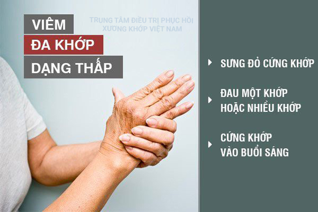 Tìm hiểu phương pháp điều trị Viêm đa khớp dạng thấp