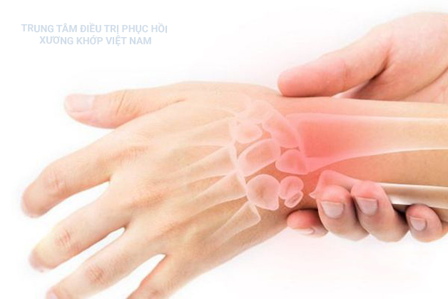 Đau khớp bàn tay bàn chân là dấu hiệu bệnh lý nào?