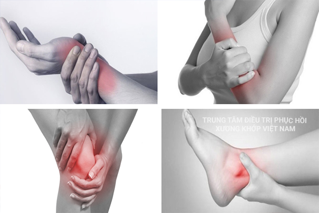 Làm sao điều trị dứt điểm bệnh Viêm đa khớp trong vòng 2 tháng