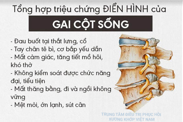 Nguyên nhân dẫn đến bệnh gai cột sống và cách điều trị hiệu quả sau 7 ngày