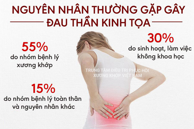 Nguyên nhân đau thần kinh tọa