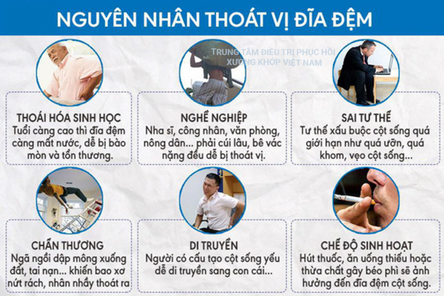 Điểm mặt các nguyên nhân bệnh thoát vị đĩa đệm và cách chữa trị