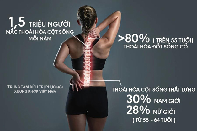 Phát hiện nhanh các triệu chứng thoái hóa cột sống thắt lưng