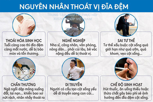 Tìm hiểu các nguyên nhân thoát vị đĩa đệm