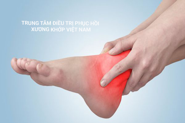 Viêm khớp cổ chân và chế độ dinh dưỡng cần biết