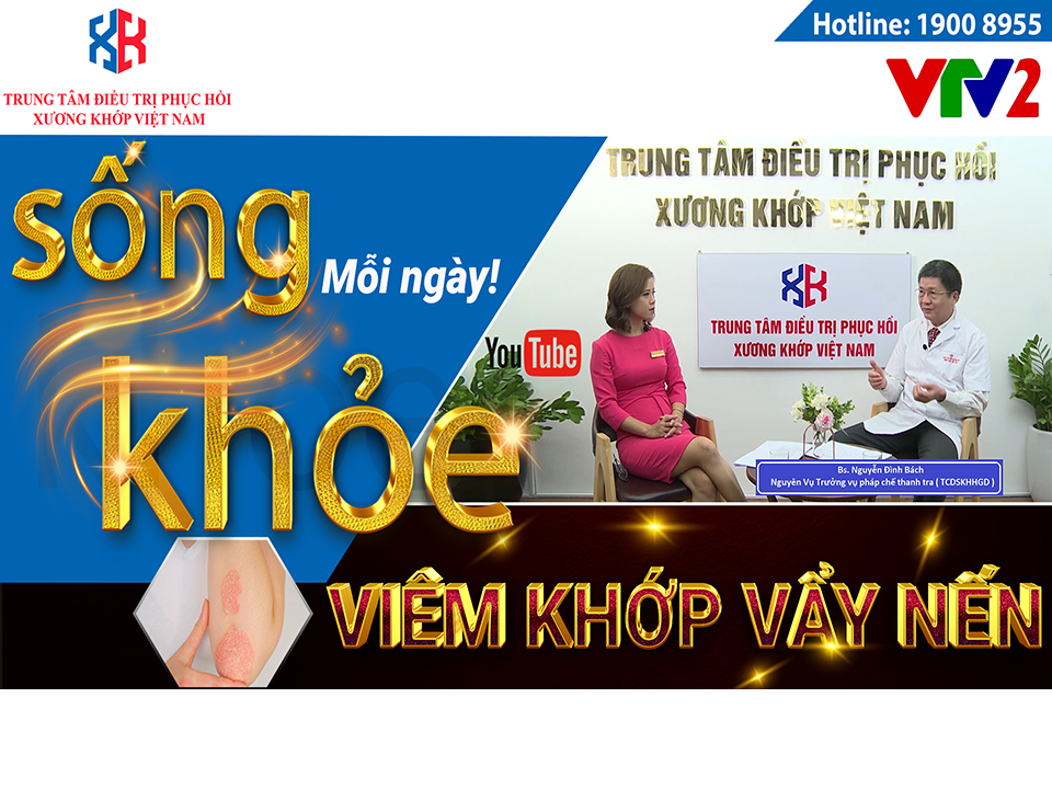 VIÊM KHỚP VẨY NẾN