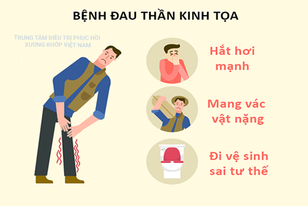 Bệnh đau thần kinh tọa