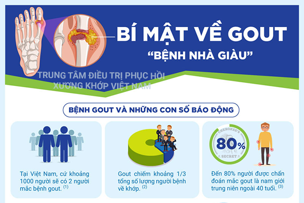 Bệnh Gout và những con số báo động 