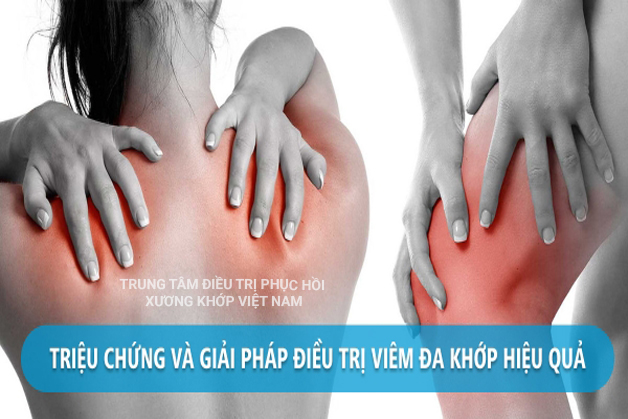 Bệnh Viêm đa khớp 2