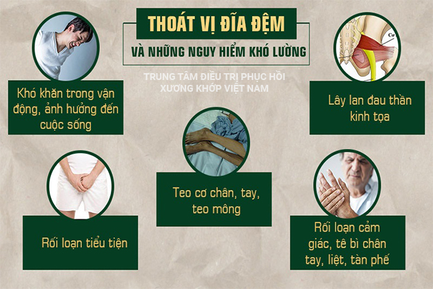 Biến chứng Thoát vị đĩa đệm