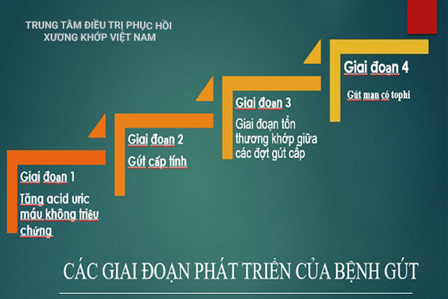 Các giai đoạn bệnh Gout