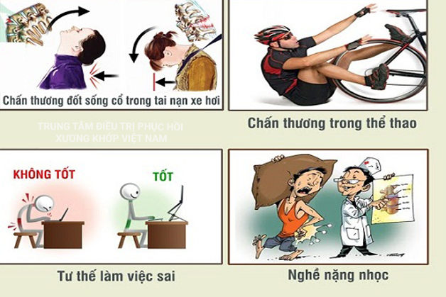 Các nguyên nhân Gai cột sống