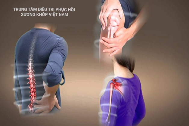 Các triệu chứng Xương khớp thường gặp