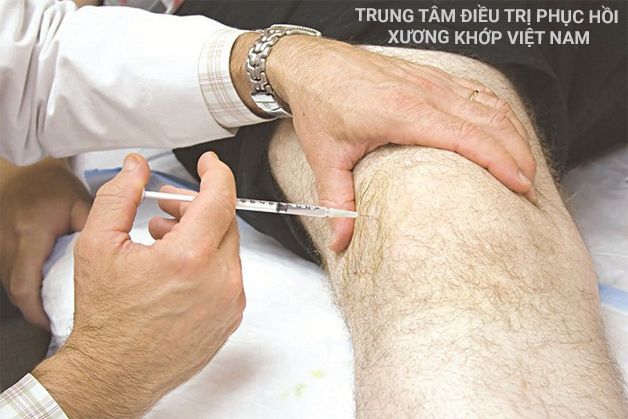 Cách điều trị Vôi hóa cột sống theo phương pháp Tây Y