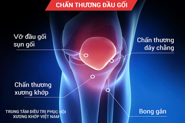 Chấn thương đầu gối