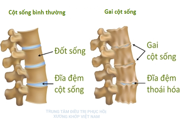 Cột sống khỏe mạnh, cột sống bình thường