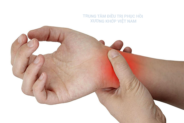 Đau khớp cổ tay