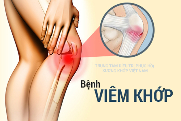 Đau xương khớp - Căn bệnh của mọi lứa tuổi