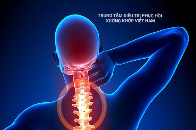 "Khốn khổ" vì những cơn đau mà bệnh xương khớp gây ra 