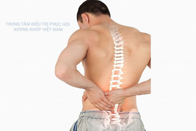 Gù, vẹp cột sống 