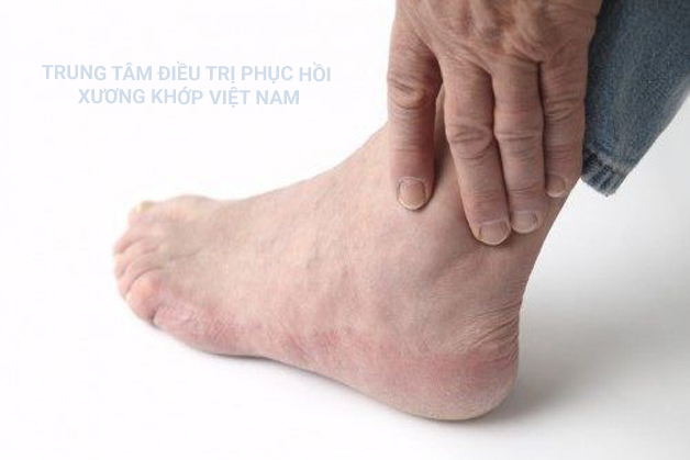 Khớp cổ chân là một trong những khớp khá quan trọng