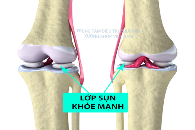 Lớp sụn khỏe mạnh