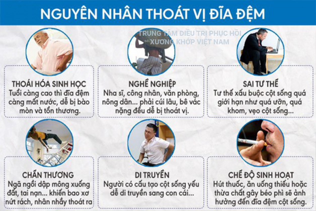 Nguyên nhân gây ra Thoát vị đĩa đệm