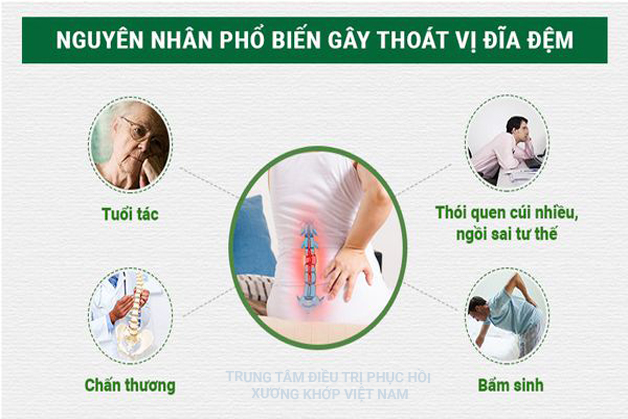 Nguyên nhân phổ biến gây thoát vị đĩa đệm