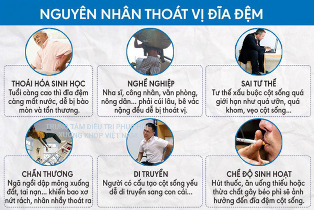 Nguyên nhân gây ra thoát vị đĩa đệm