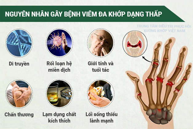 Nguyên nhân Viêm đa khớp dạng thấp