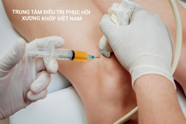 Tiêm corticoid tại chỗ 