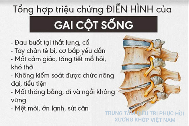 Triệu chứng của bệnh Gai cột sống