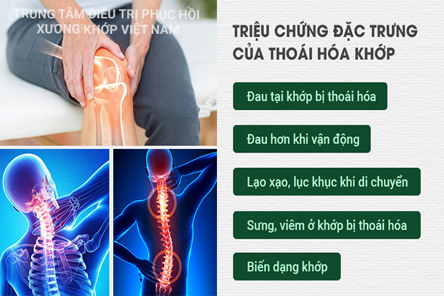  Triệu chứng Thoái hóa khớp 