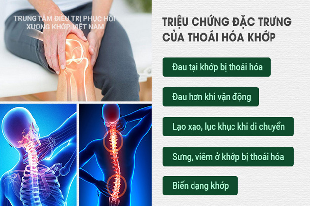 Triệu chứng Thoái hóa khớp