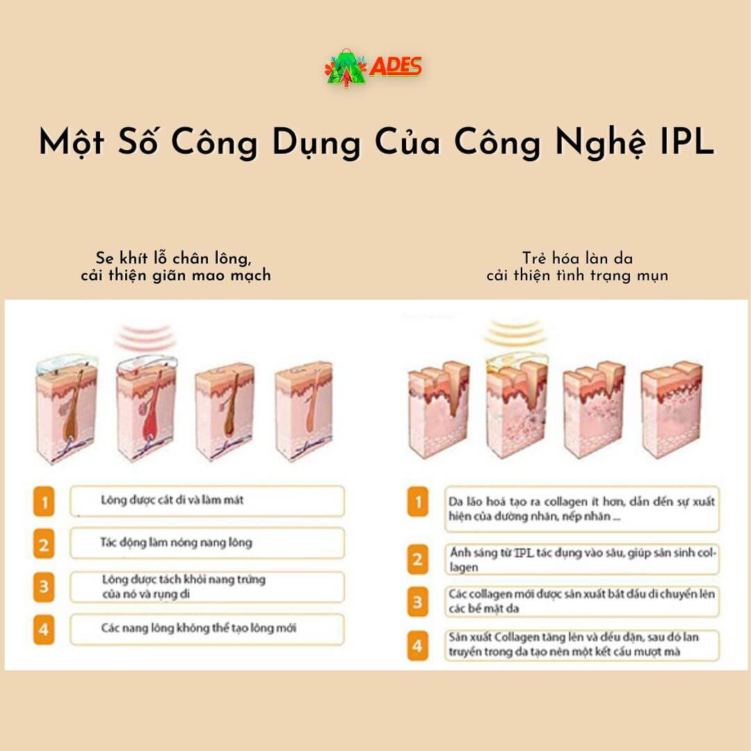 mot so cong dung cua cong nghe ipl