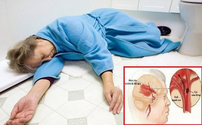 cách phòng đột quỵ cai lậy