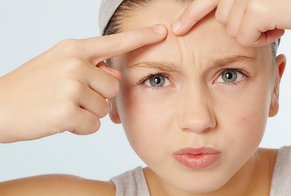 Bí kíp giúp da hết nhờn và mụn cám với nguyên liệu thiên nhiên