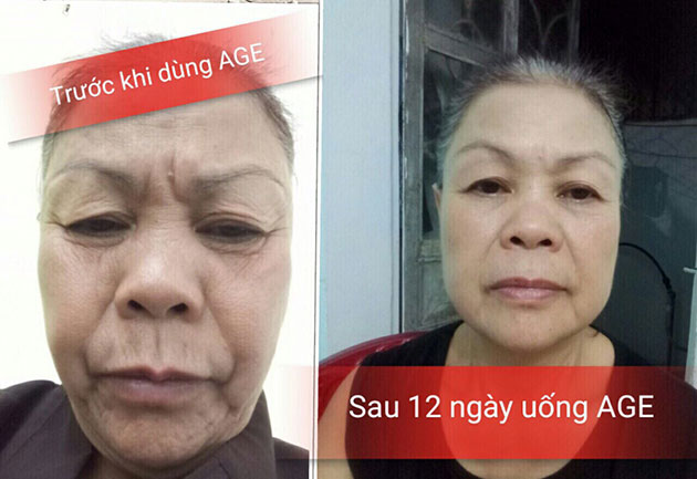 Kết quả khi sử dụng viên uống sisel age pill