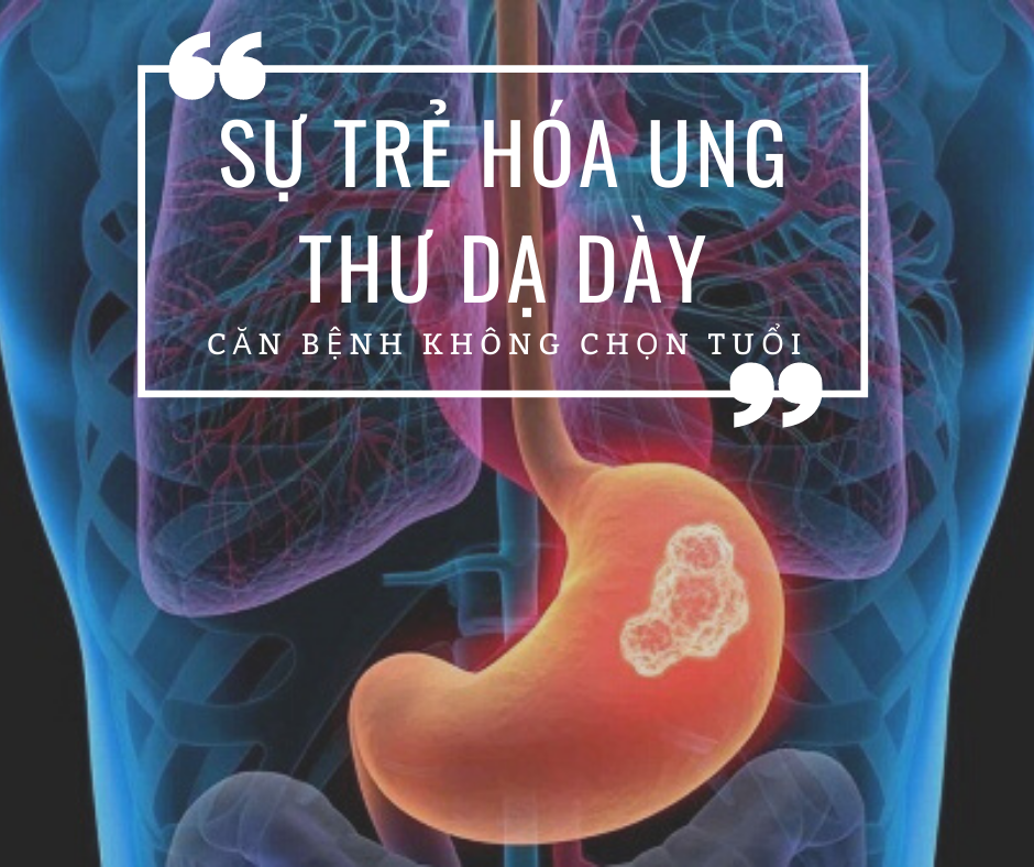 Sự 