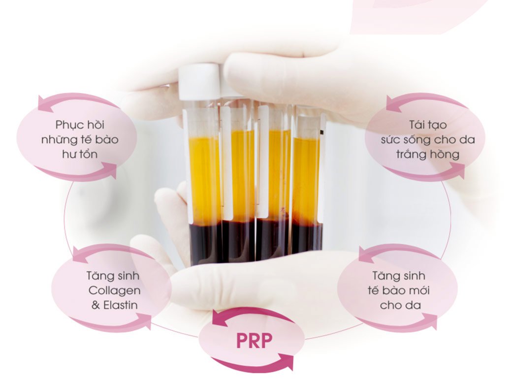 cấy prp có tác dụng gì