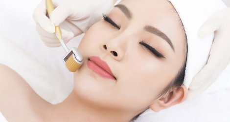 Lăn kim tại spa