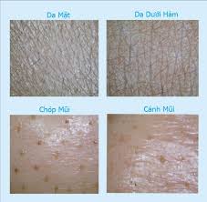 máy soi da cá nhân cầm tay