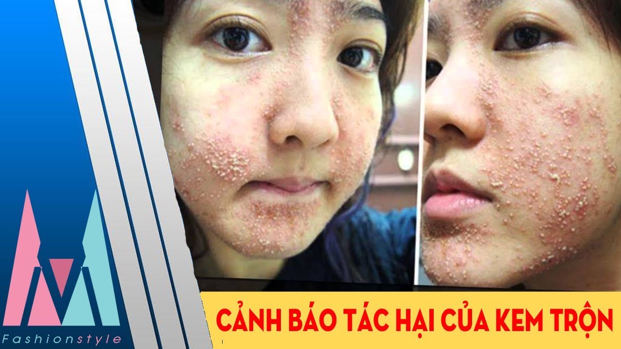Tác hại của kem trộn
