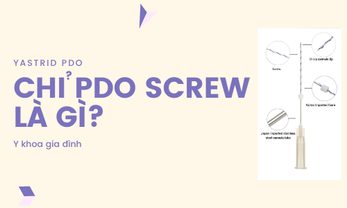 Chỉ PDO xoắn Chỉ PDO xoắn